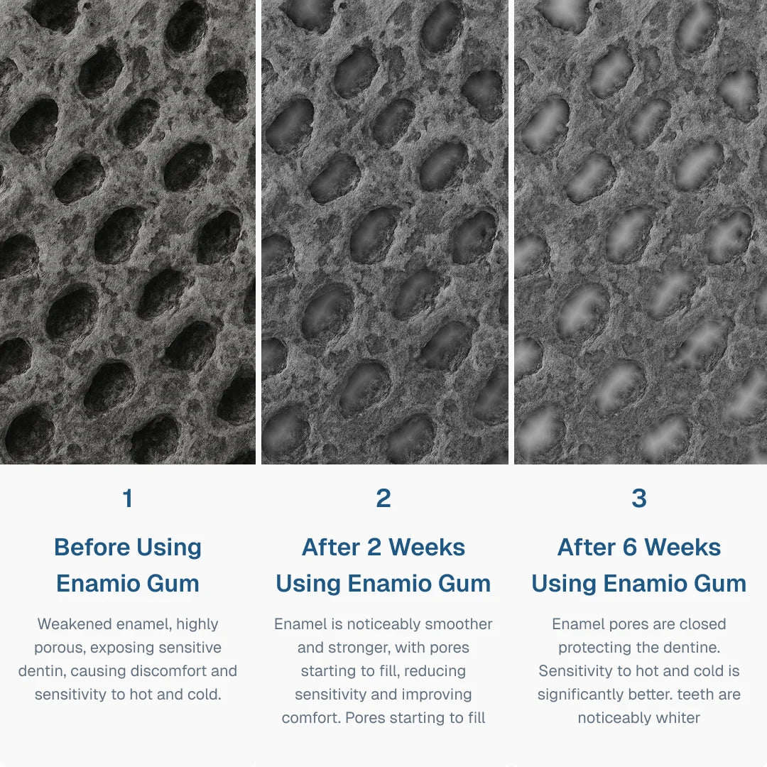 Enamio remineralizing gum with nano-hydroxyapatite, a remineralizing gum for sensitive teeth